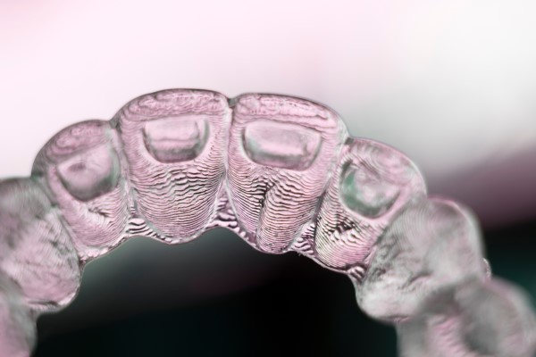 Invisalign Therapy: Custom Treatment And Fitted Aligners